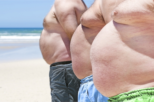 obesidade